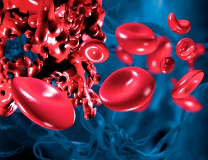 Inhibitory srážecích faktorů komplikují léčbu hemofilie