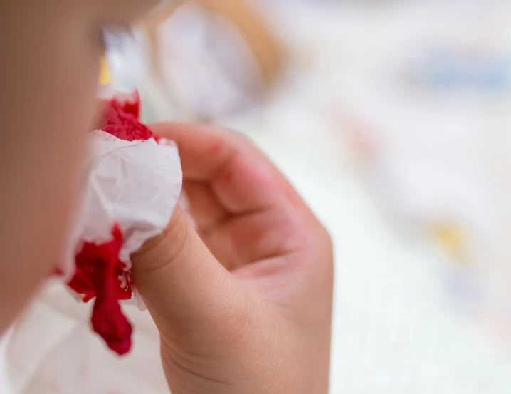 Časté krvácení z nosu u dětí – může jít o projev hemofilie?