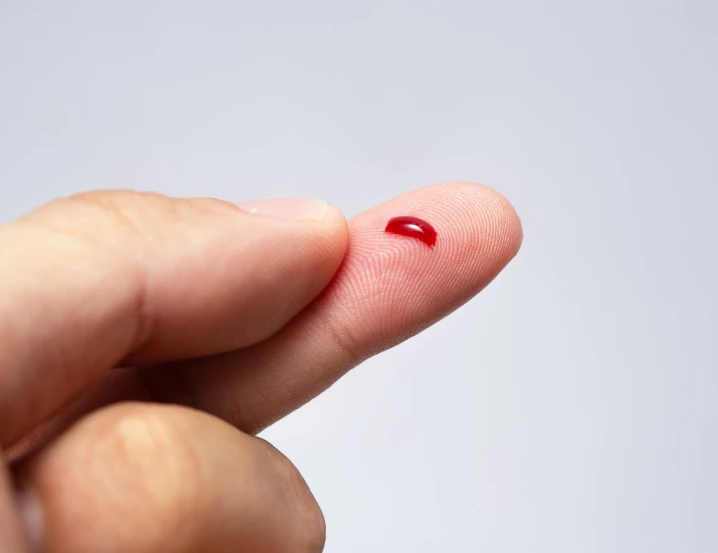 Nová doporučení pro prevenci krvácení u hemofilie – to nejdůležitější, co potřebujete vědět